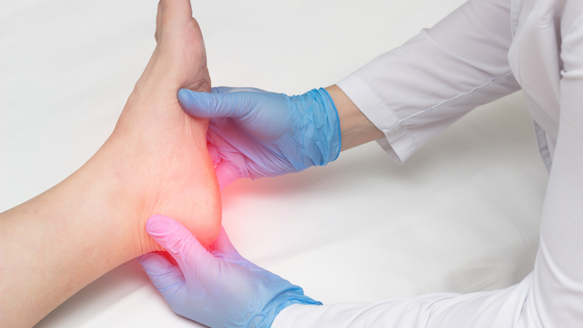 plantar fasciitis