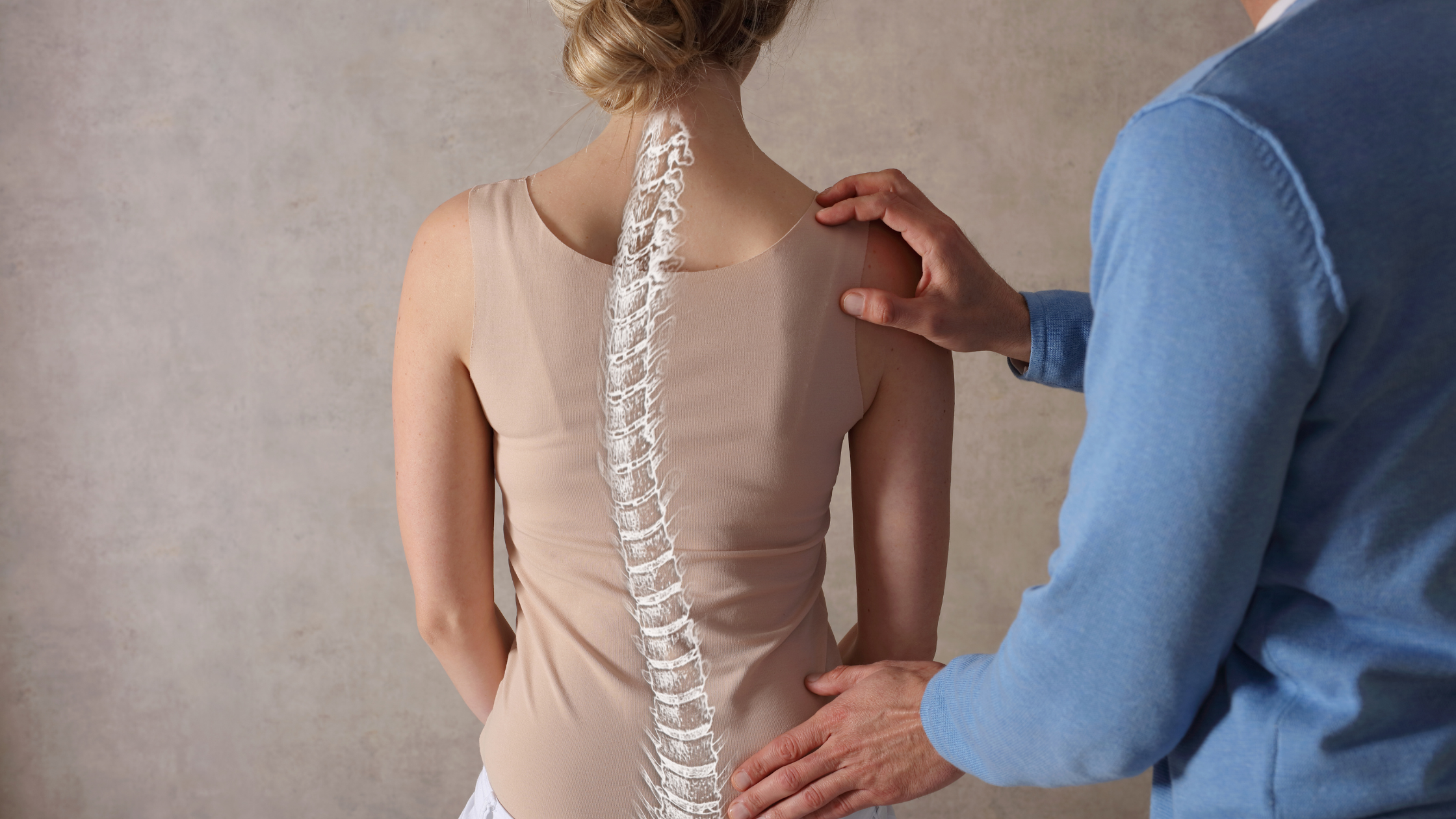 adult degenerative scoliosis