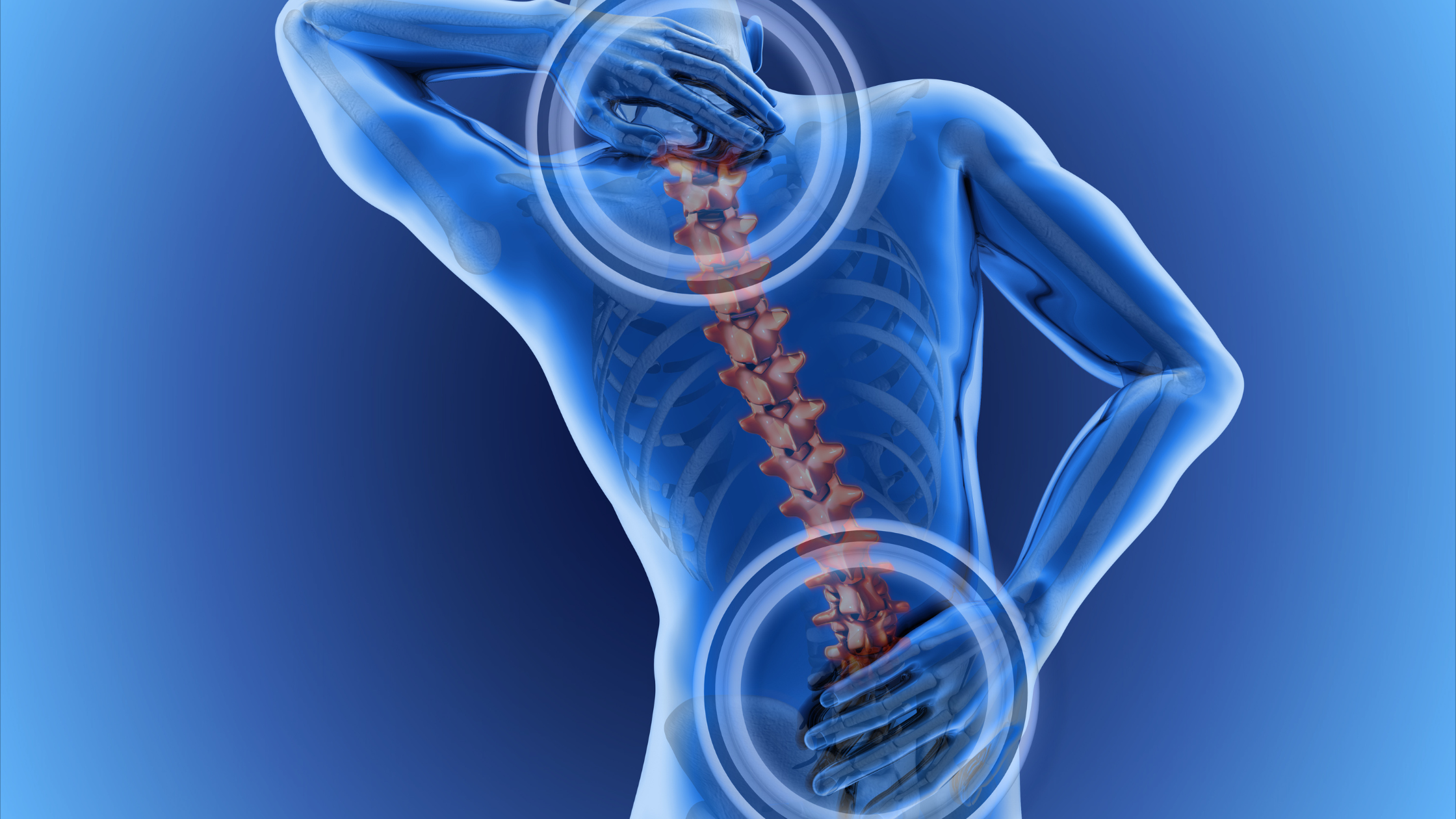 radiofrequency ablation for chronic back pain